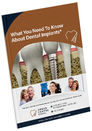 Dental Implant Guide Cover Image by Urban Centre Dental with tooth enamel