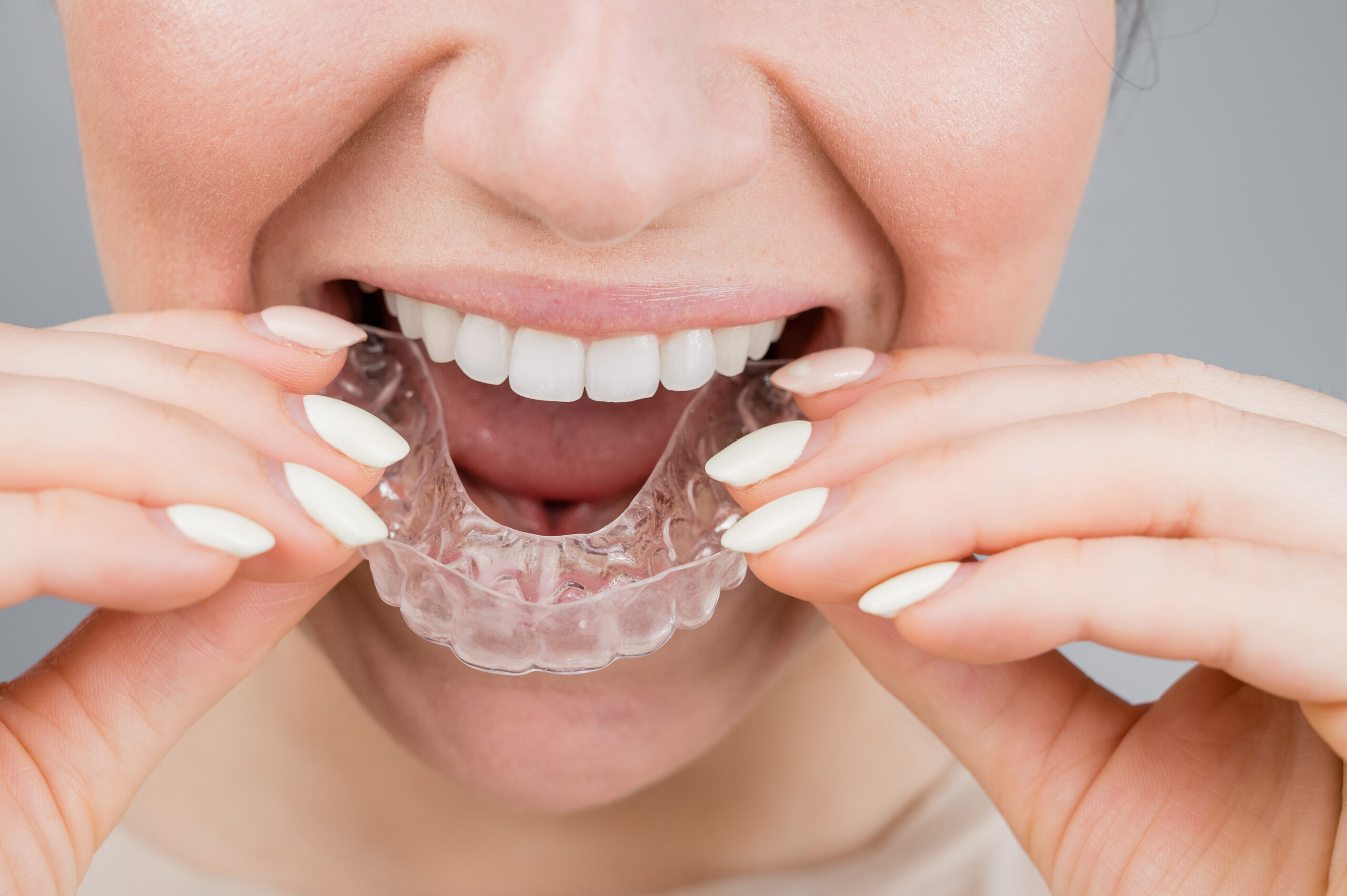 Featured image for “Protecting Cosmetic Dental Work for Long-Lasting Results”